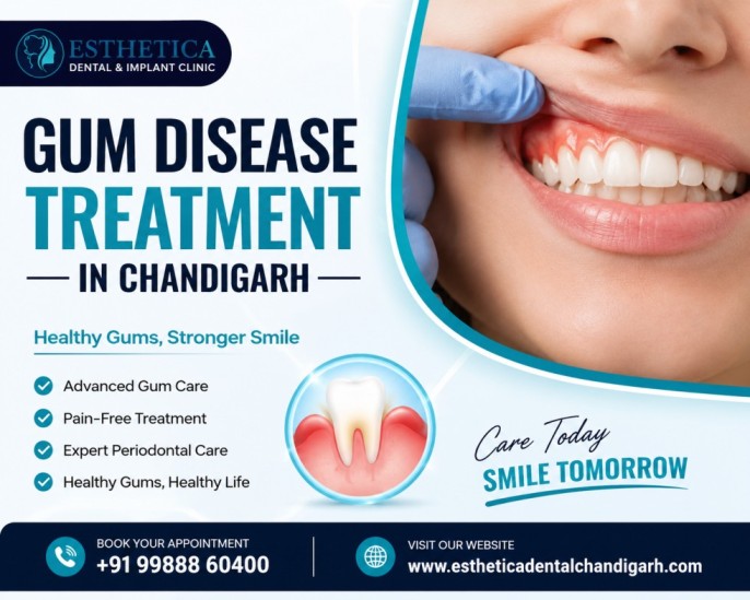 gum disease treatment in Chandigarh