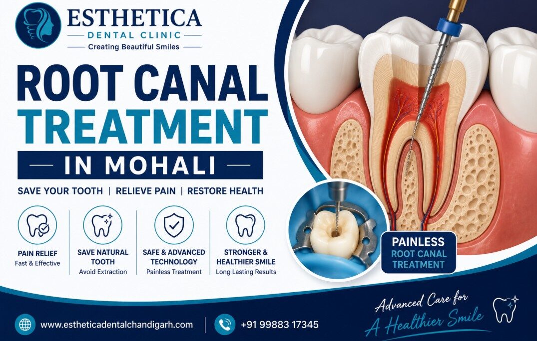 root canal treatment in Mohali