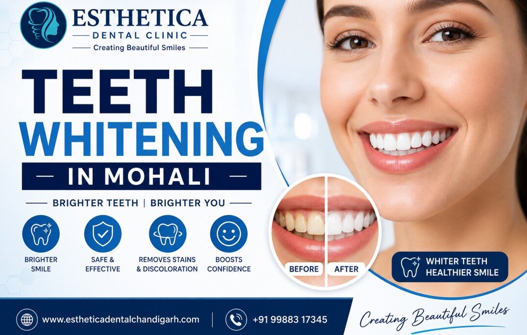 teeth whitening in Mohali