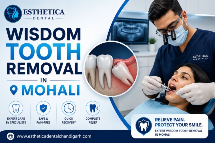 wisdom tooth removal in Mohali