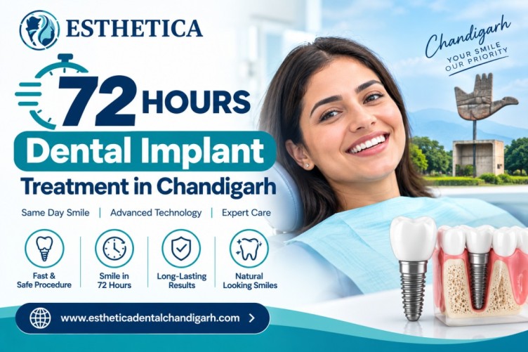 72 Hours Dental Implant in India Fast Tooth Replacement Treatment