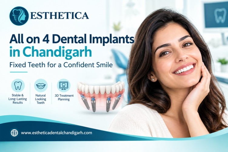 All on 4 Dental Implants in Chandigarh