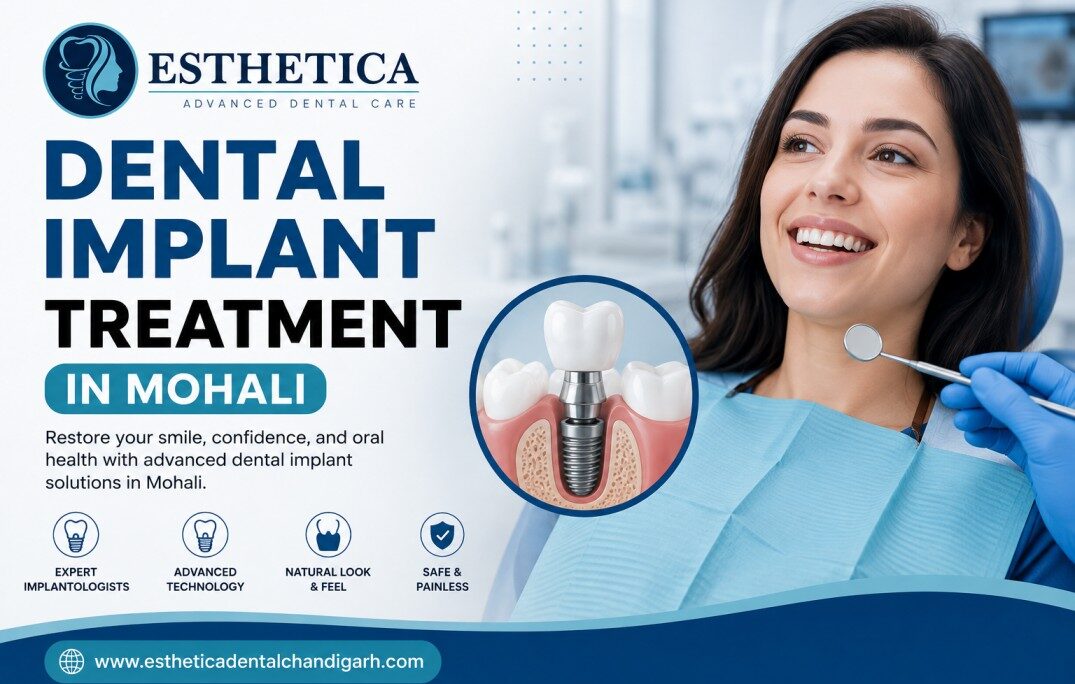 Dental Implant Treatment in Mohali