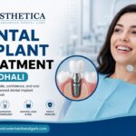 Dental Implant Treatment in Mohali