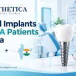 Dental Implants for USA Patients in India