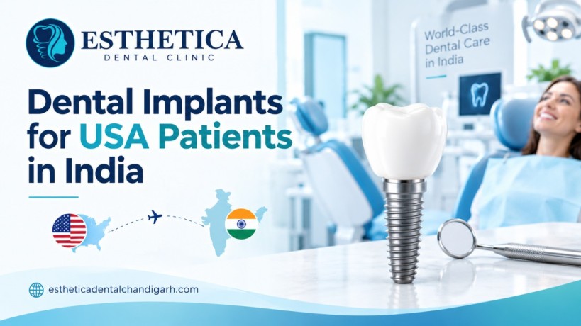 Dental Implants for USA Patients in India