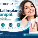 Dental Implants in Panipat