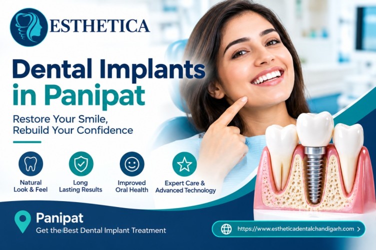 Dental Implants in Panipat
