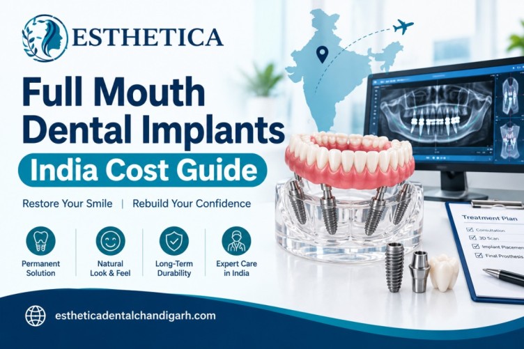 Full Mouth Dental Implants India Cost