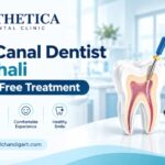 Root Canal Dentist in Mohali