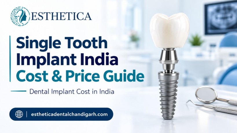 Single Tooth Implant India Cost
