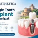 Single Tooth Implant in Panipat