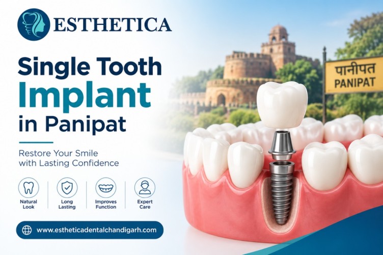 Single Tooth Implant in Panipat