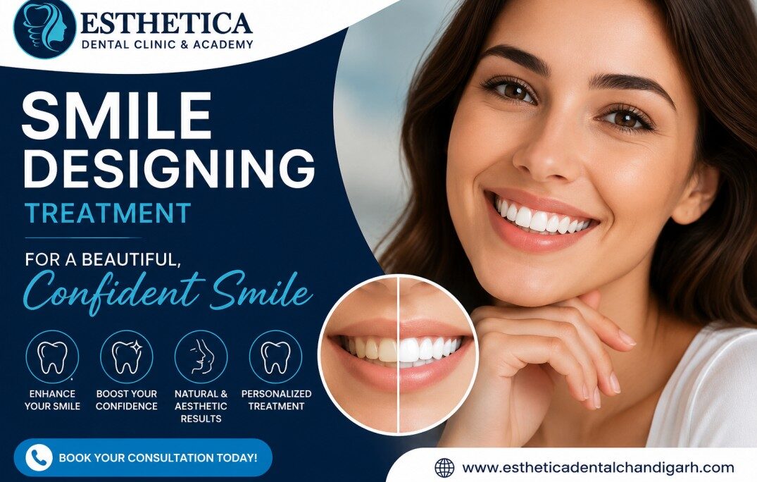 Smile Designing Treatment for a Beautiful Confident Smile