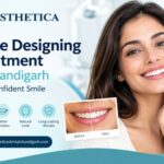 smile-designing-treatment-Chandigarh