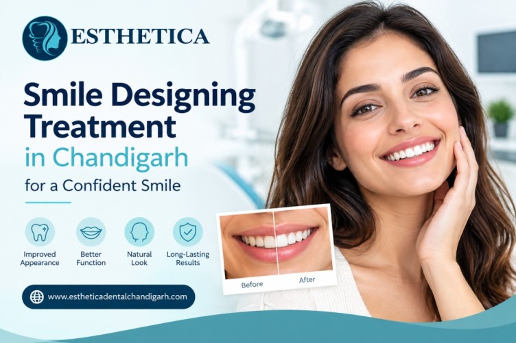smile-designing-treatment-Chandigarh