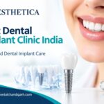 Best Dental Implant Clinic India