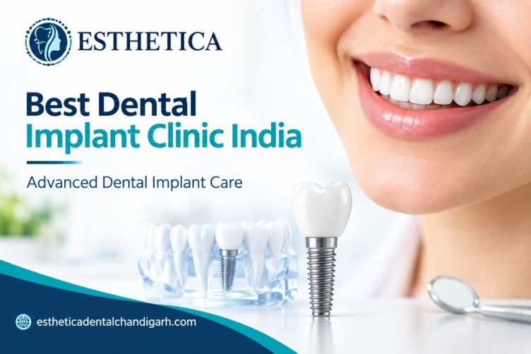 Best Dental Implant Clinic India