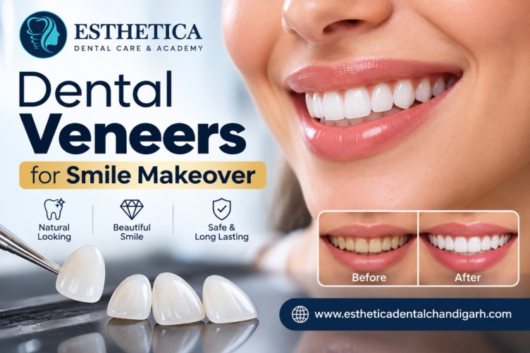 smile design