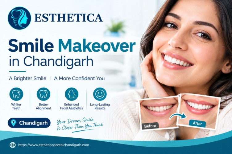 smile makeover in Chandigarh